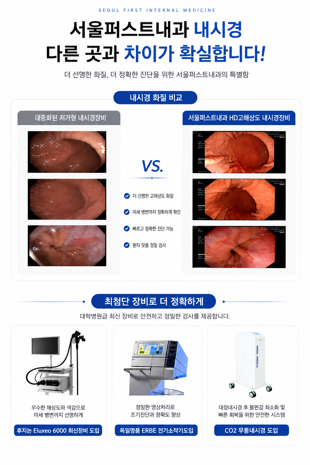 서울퍼스트내과 내시경 화질 비교 — 후지논 Eluxeo 6000 HD 내시경, CO2 투명내시경 도입